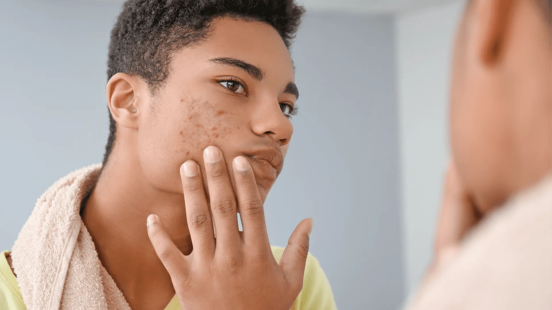 Close-up of clear, healthy skin after acne treatment using BBL and microneedling therapies.