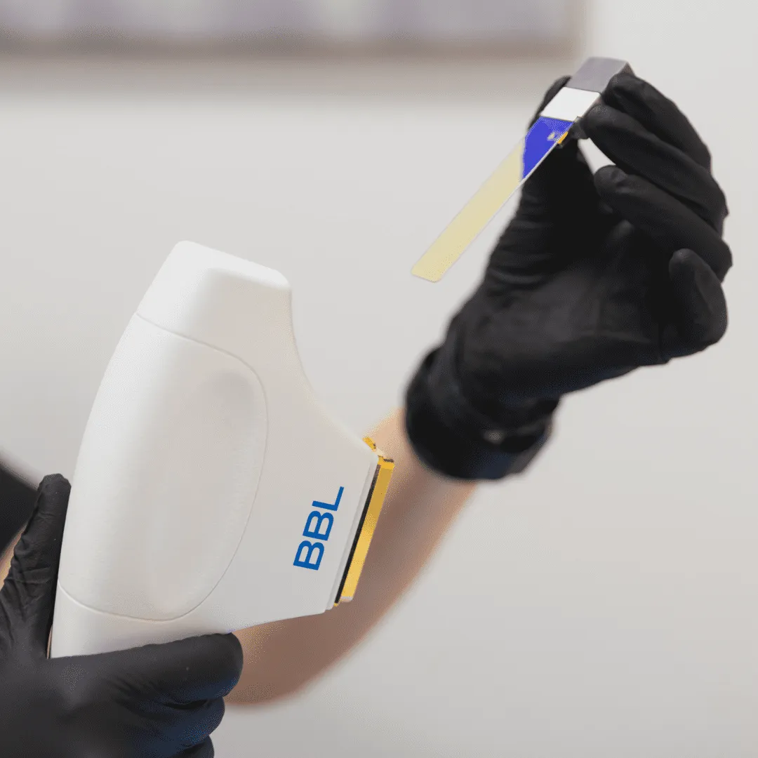 Close up image of the BroadBand Light (BBL) Therapy technology.