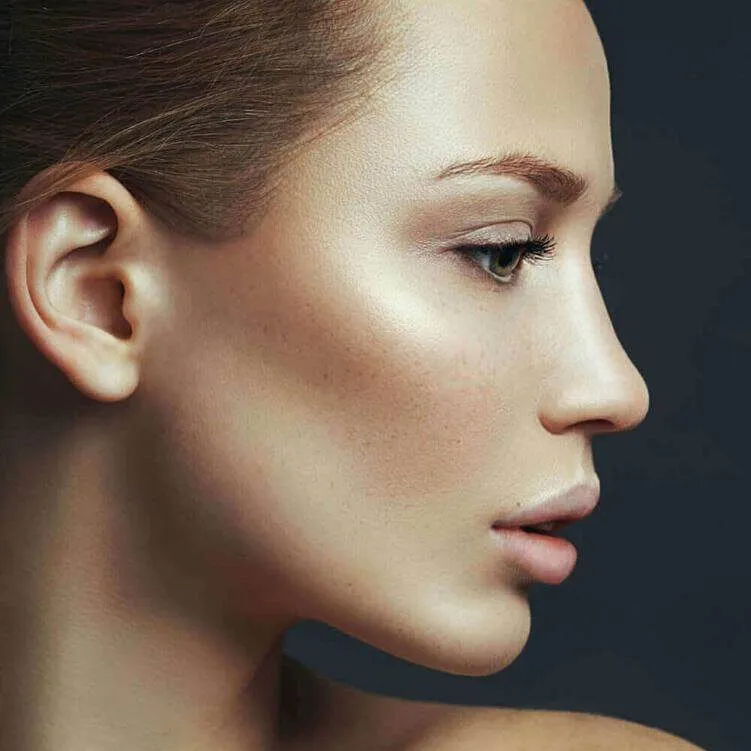 Results of Dermal Fillers injectables treatment.