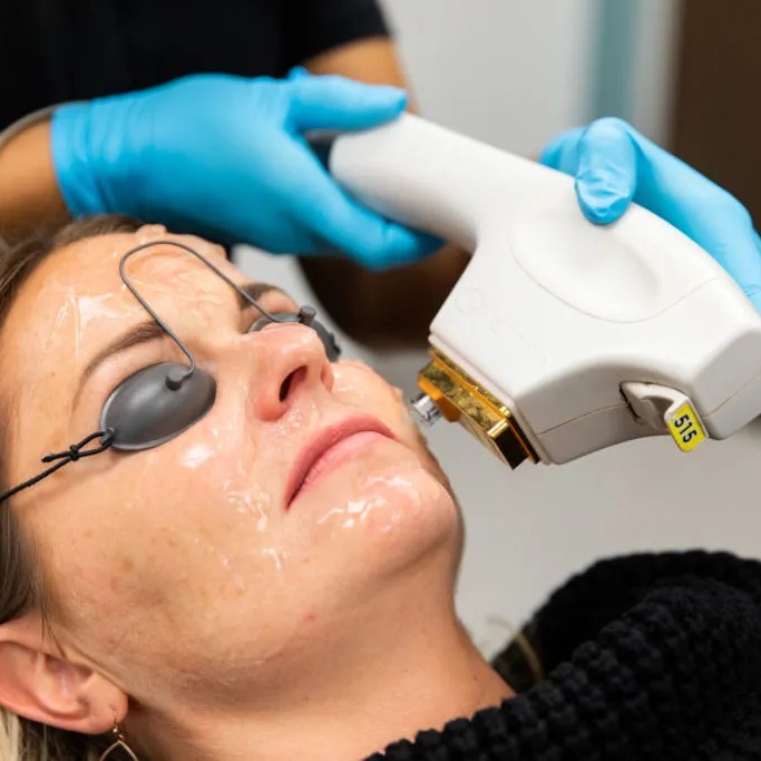 Woman receiving SkinTyte Skin-Tightening treatment at Encompass Wellness & Aesthetics.