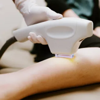 Forever Bare BBL treatment on a patients leg.