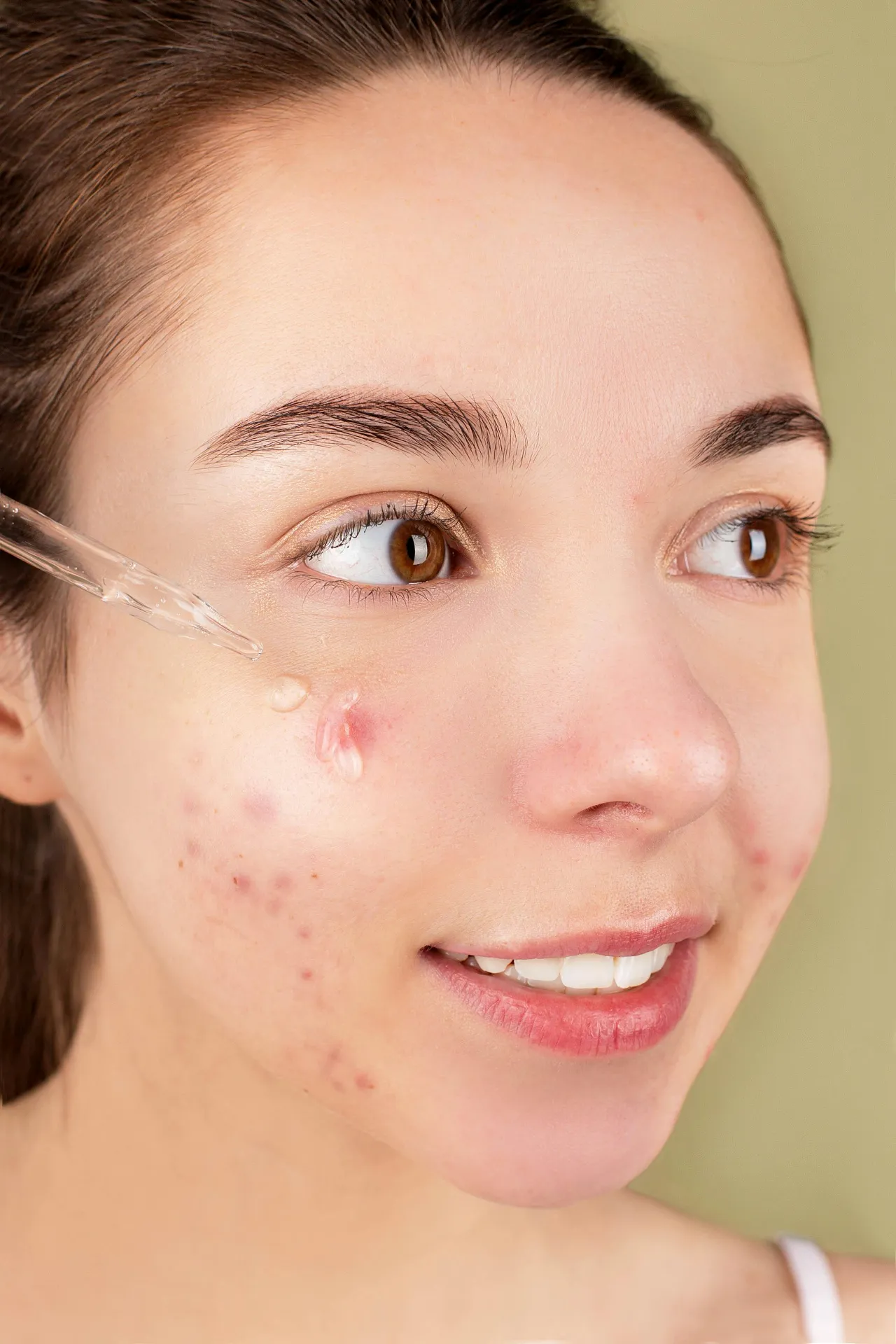 Close-up of woman applying facial serum to acne-prone skin, illustrating Peptide Therapy skin rejuvenation goals